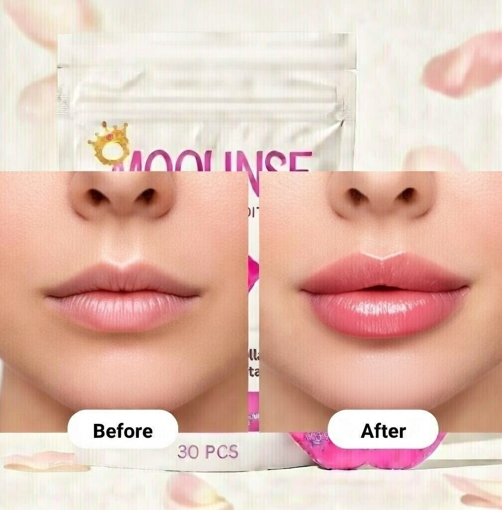 Lip-Cloud Mouth Tape