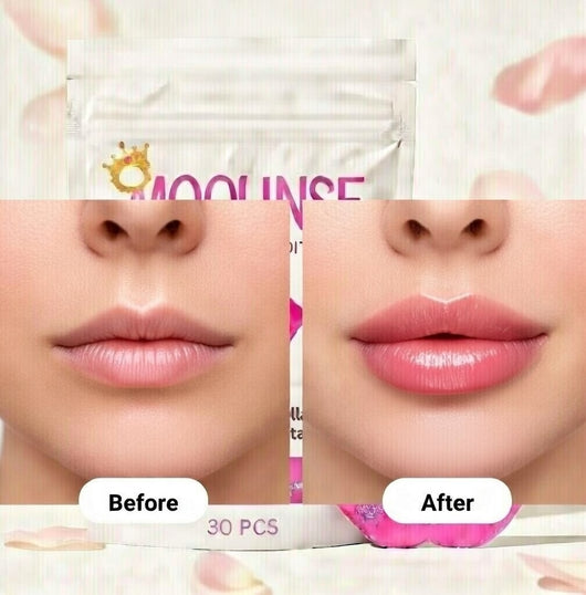 Lip-Cloud Mouth Tape